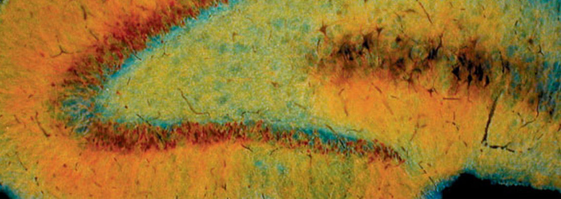 Brain image by Dr. Gyorgy Buzsaki