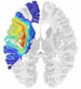Human Brain