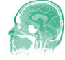 Brain